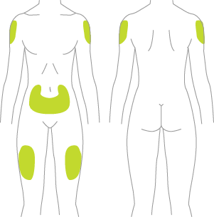 Áreas del cuerpo donde se puede inyectar Tresiba®